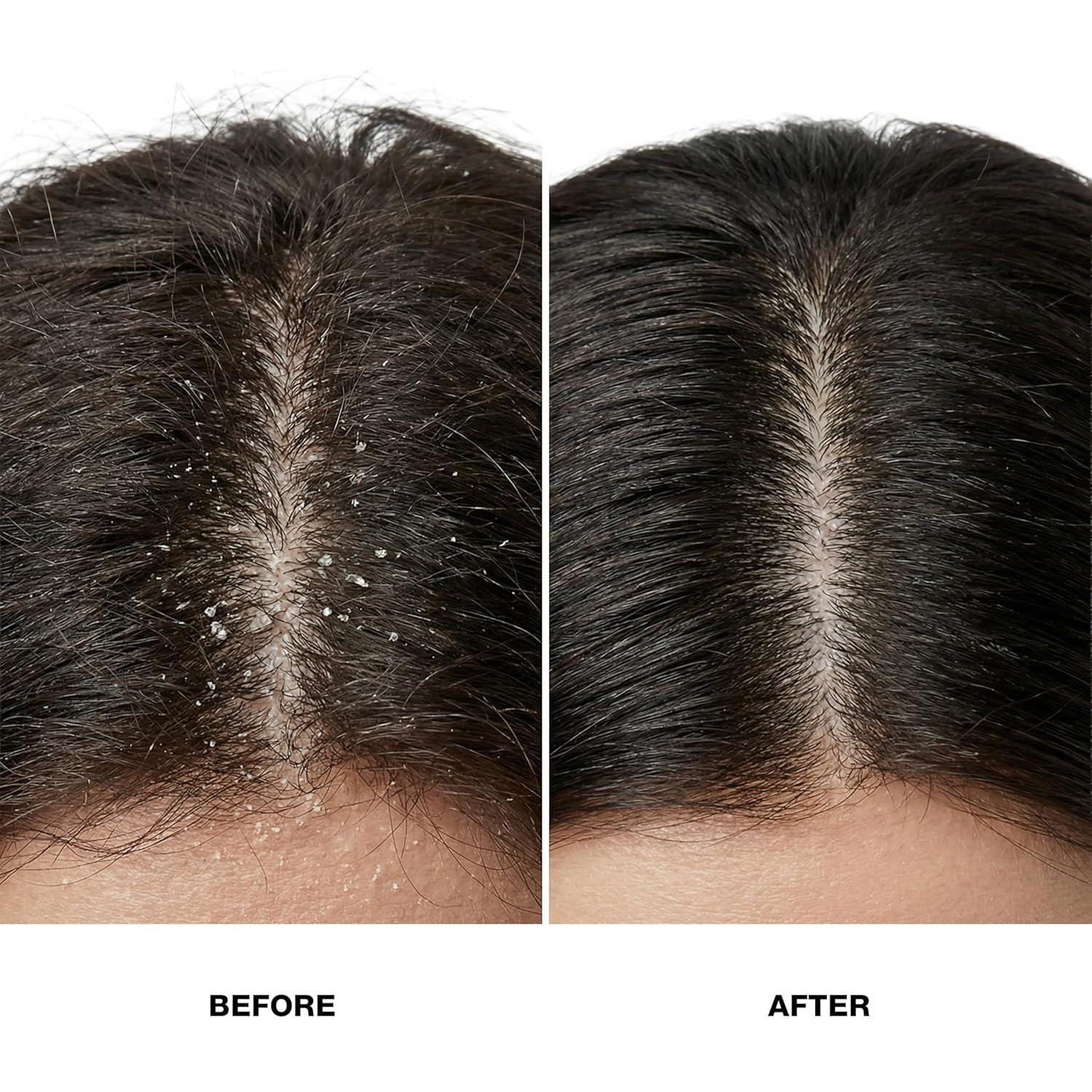image:imageGK HAIR Balancing Shampoo Repairs Dry Damage For Oily Flaky Itchy Scalp Thinning Removes Impurities Deep Cleansing Natural Moisture Keratin Treatment Sulfate Parabem Free All Hair Types 338 OunceAnti Dandruff 85 Fl Oz