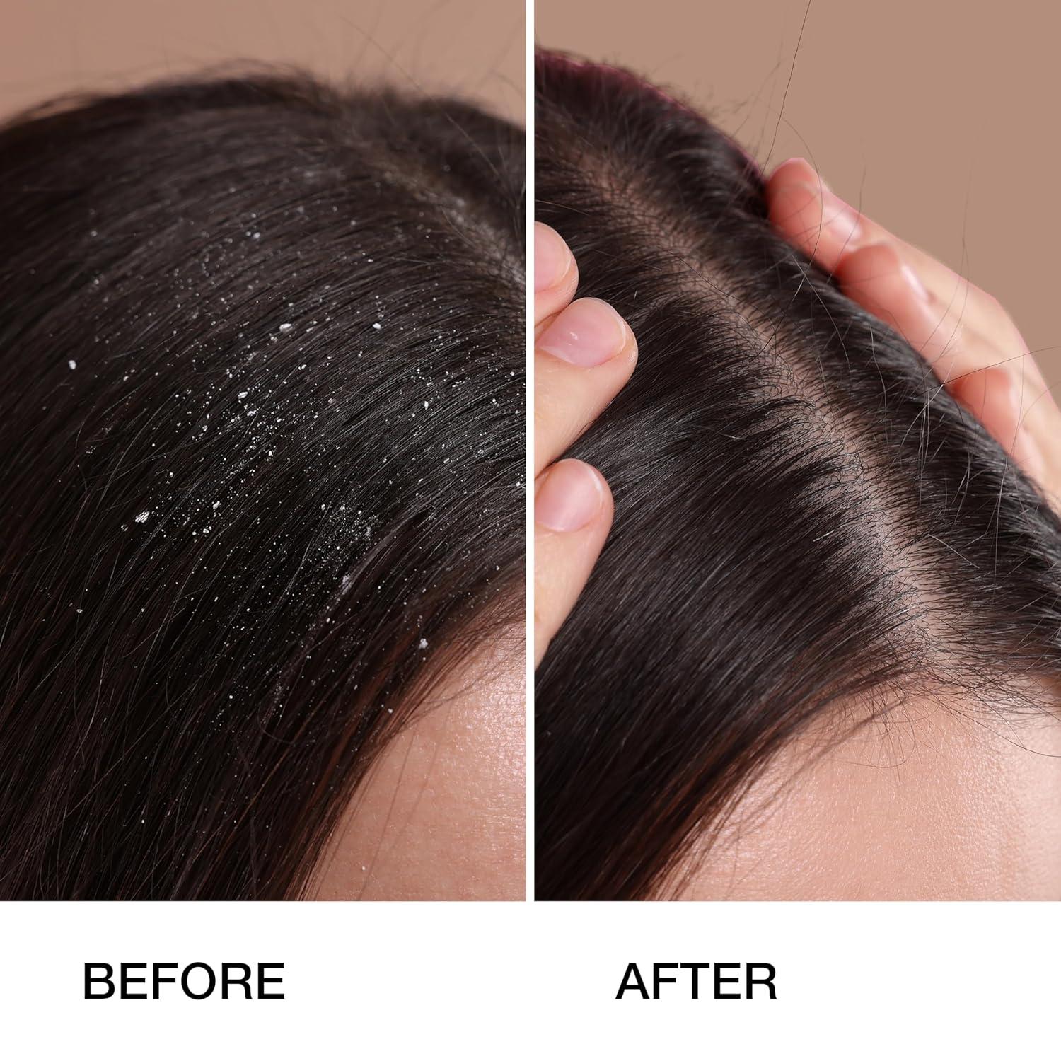 image:imageGK HAIR Global Keratin Anti Dandruff Shampoo 250ml Global Keratin Organic Argan Oil Hair Serum For Frizz Control Dry Damage Hair Repair 50ml